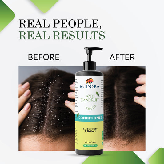 Midora Anti Dandruff Conditioner, For Itchy Flaky & Stubborn, All Hair Types, 200ml