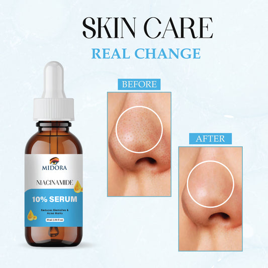Niacinamide Serum for Face | 10% Niacinamide + Zinc | Oil Control, Acne Marks & Pore Minimizer | Skin Brightening & Hydrating Face Serum for Men & Women