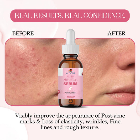 Alpha Arbutin Serum for Dark Spots & Pigmentation | Skin Brightening & Even Tone | Face Serum for Glowing Skin | Suitable for All Skin Types – 30ml
