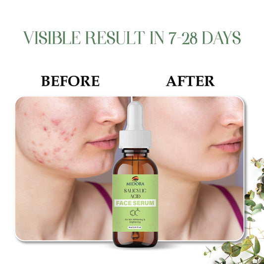Salicylic Acid Serum for Acne & Oil Control | Anti-Acne, Blackhead Removal & Pore Minimizer | Face Serum for Clear, Smooth & Glowing Skin
