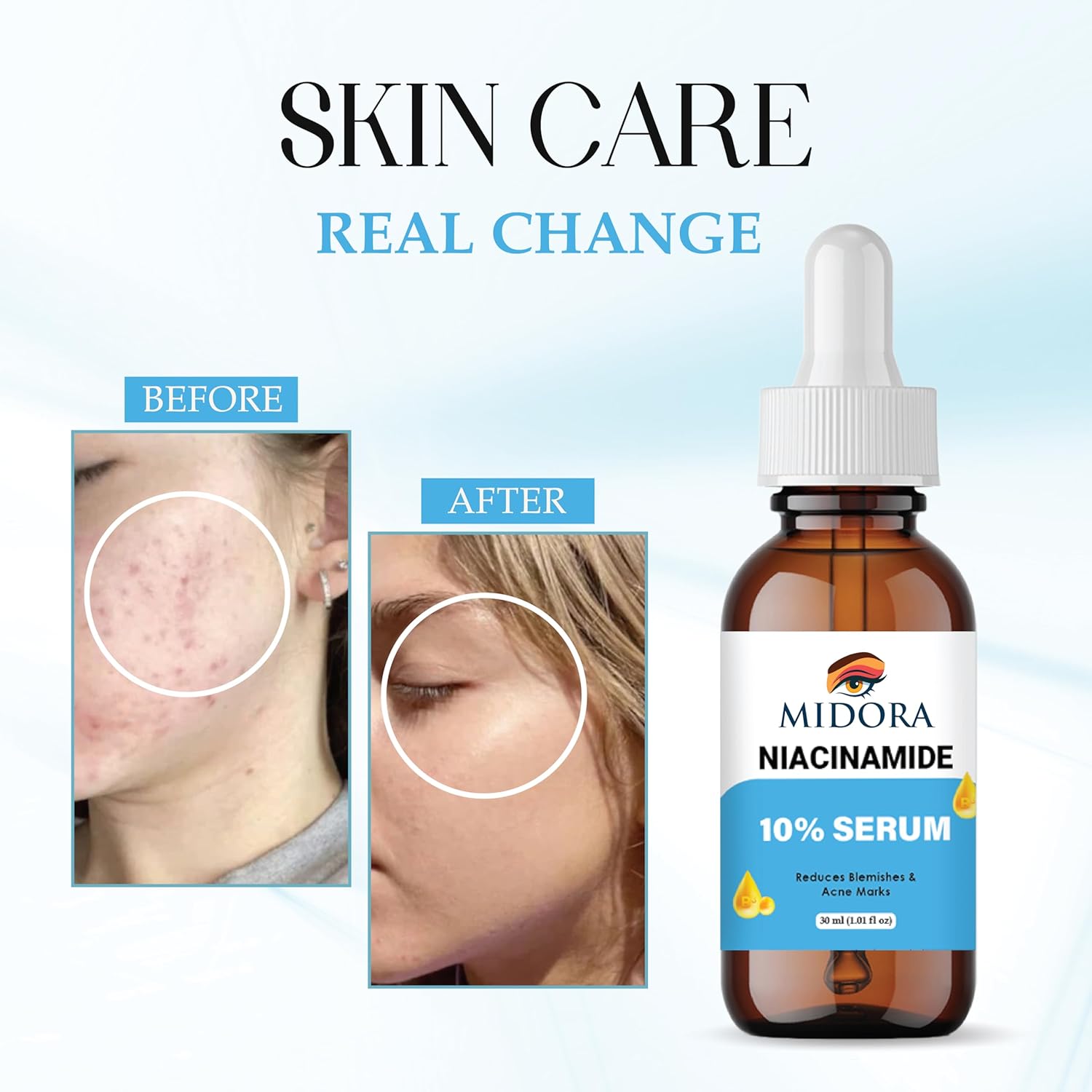 Midora Niacinamide Face Serum | 10% Niacinamide with Zinc