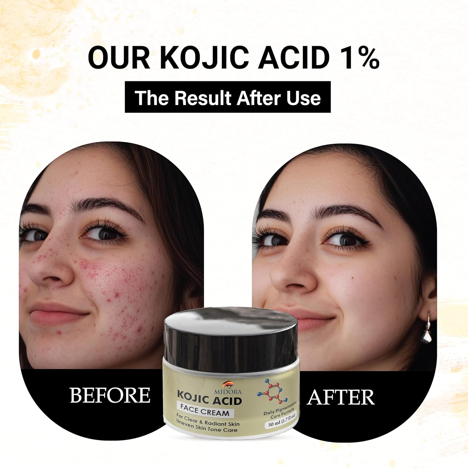 Midora Kojic Acid Face Cream 1%, Daily Pigmentation Care Formula, Clear & Radiant Skin, Uneven Skin Tone Care, 50ml