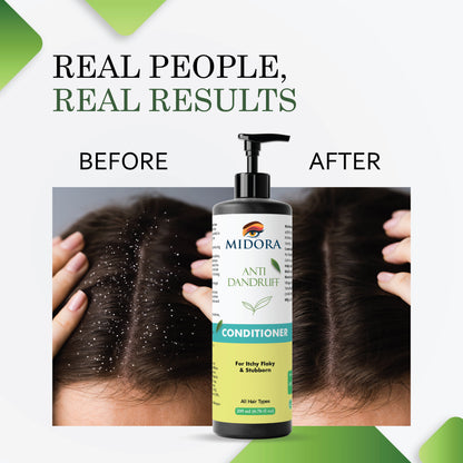 Midora Anti Dandruff Conditioner, For Itchy Flaky & Stubborn, All Hair Types, 200ml