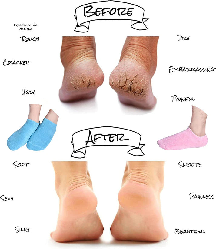 Silicone Gel Socks