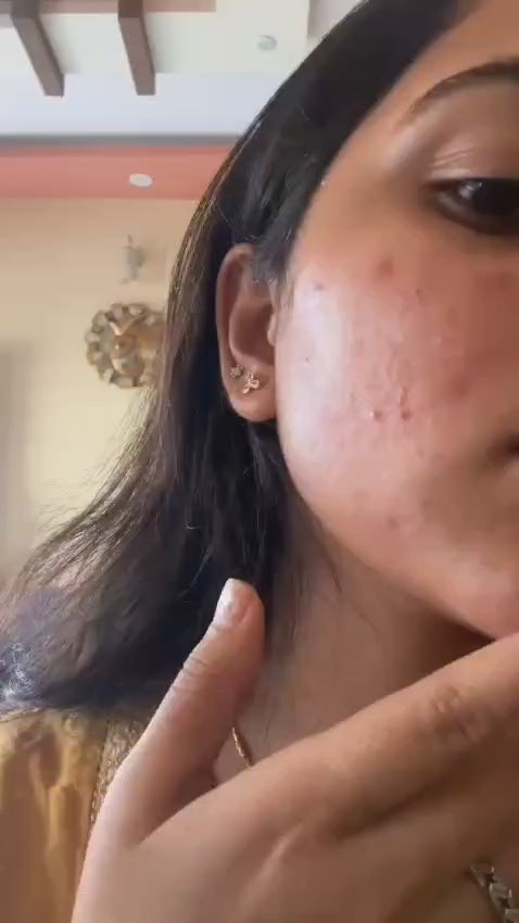 MIDORA Spot Removal Serum
